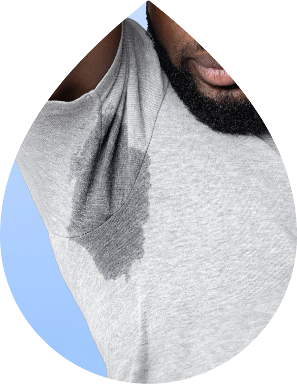 Man showing excessive underarm sweat stain on gray shirt caused by hyperhidrosis